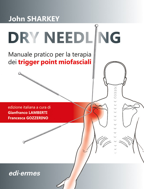Dry Needling. Manuale pratico per la terapia dei trigger point miofasciali