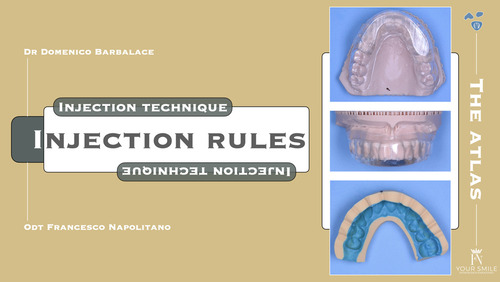 Injection Rules. injection technique