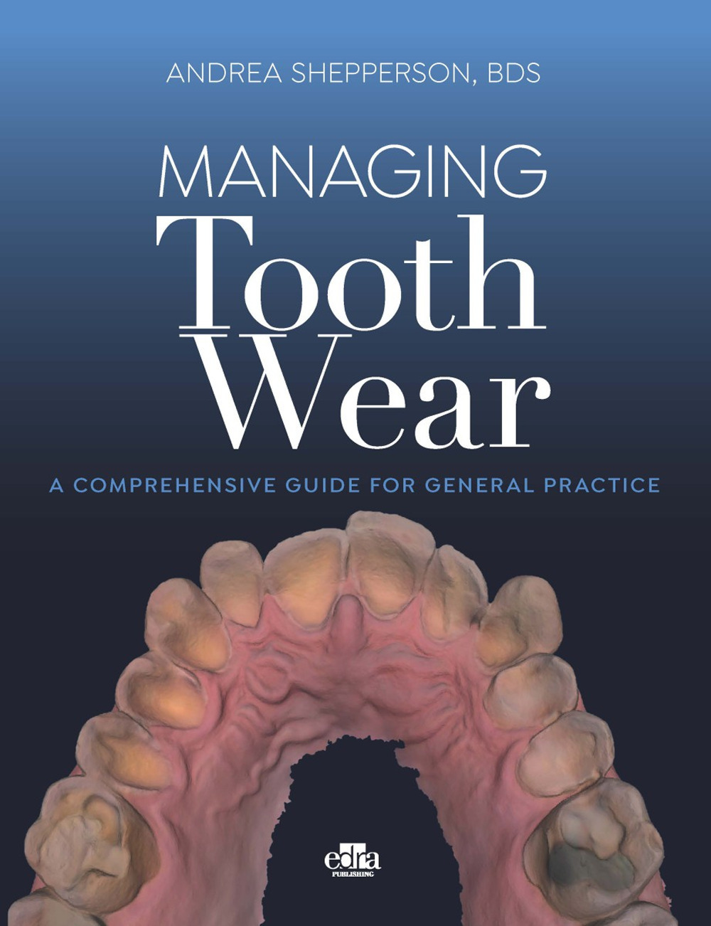 Managing tooth Wear. A comprehensive guide for general practice