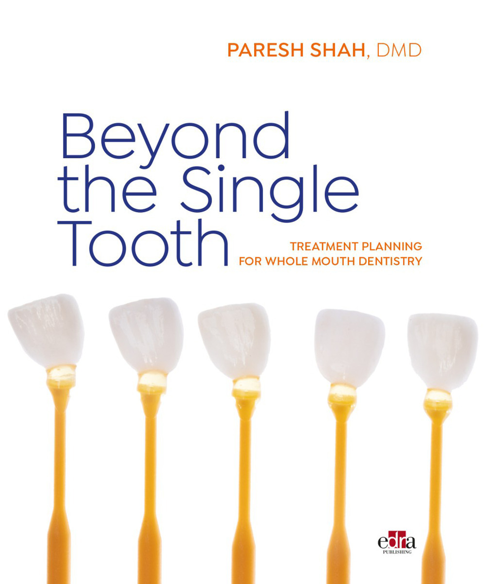 Beyond the Single Tooth. Treatment planning for whole mouth dentistry