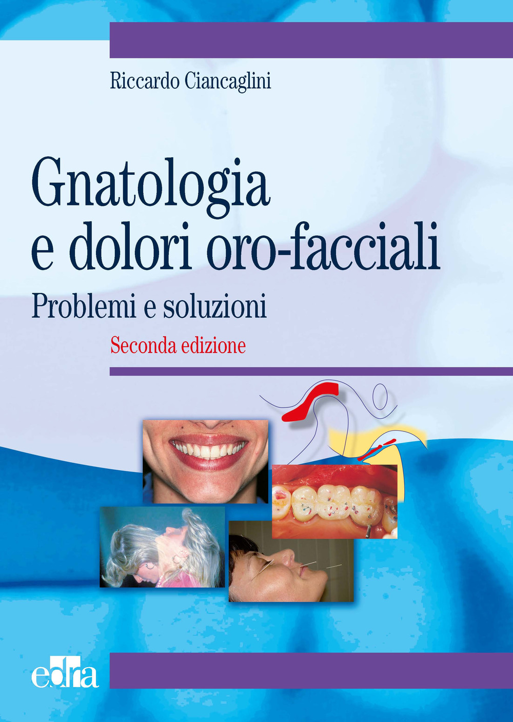 Gnatologia e dolori oro-facciali. Problemi e soluzioni