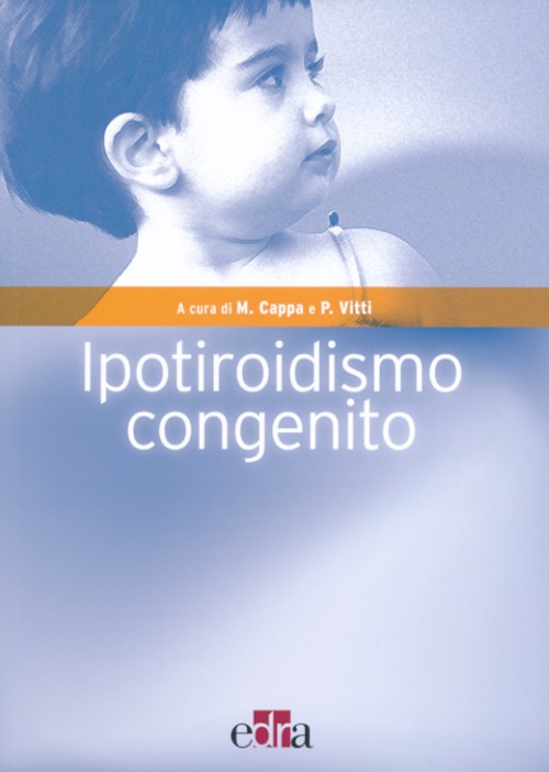 Ipotiroidismo congenito