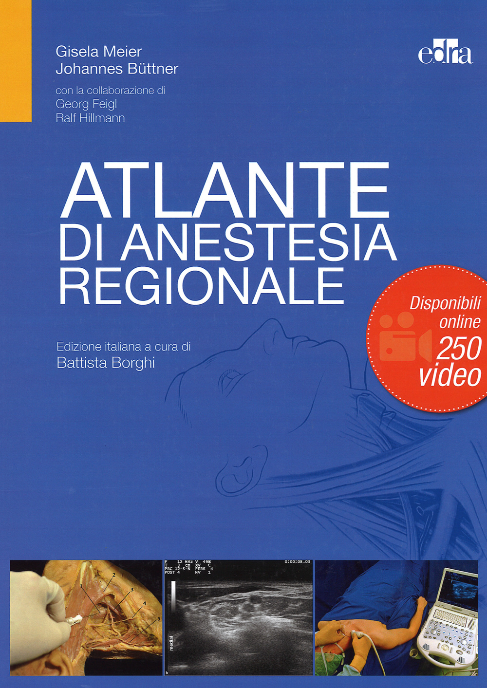 Atlante di anestesia regionale