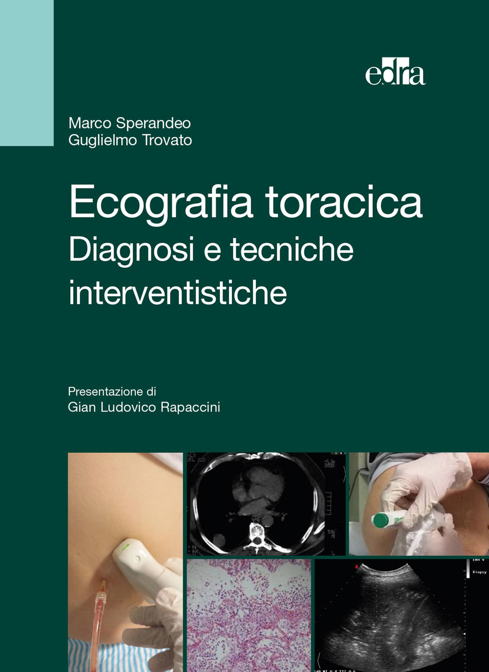 Ecografia toracica. Diagnosi e tecniche interventistiche. Ediz. illustrata