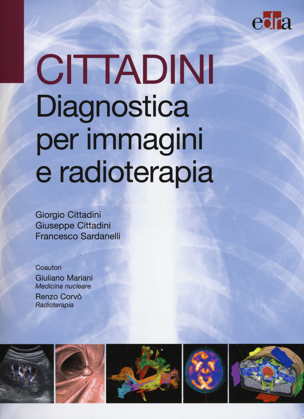 Cittadini. Diagnostica per immagini e radioterapia. Ediz. illustrata