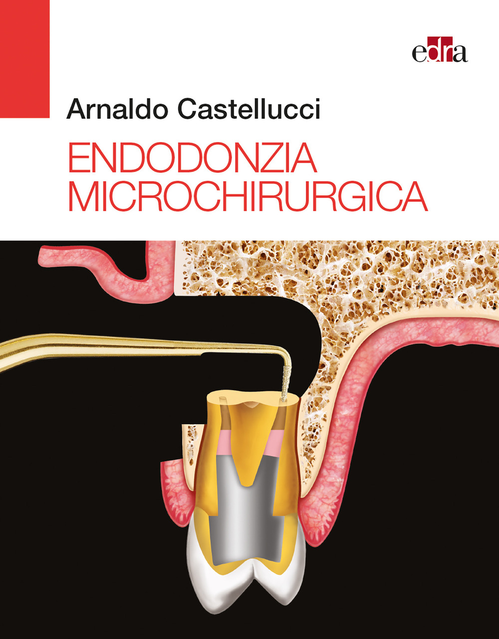 Endodonzia microchirurgica