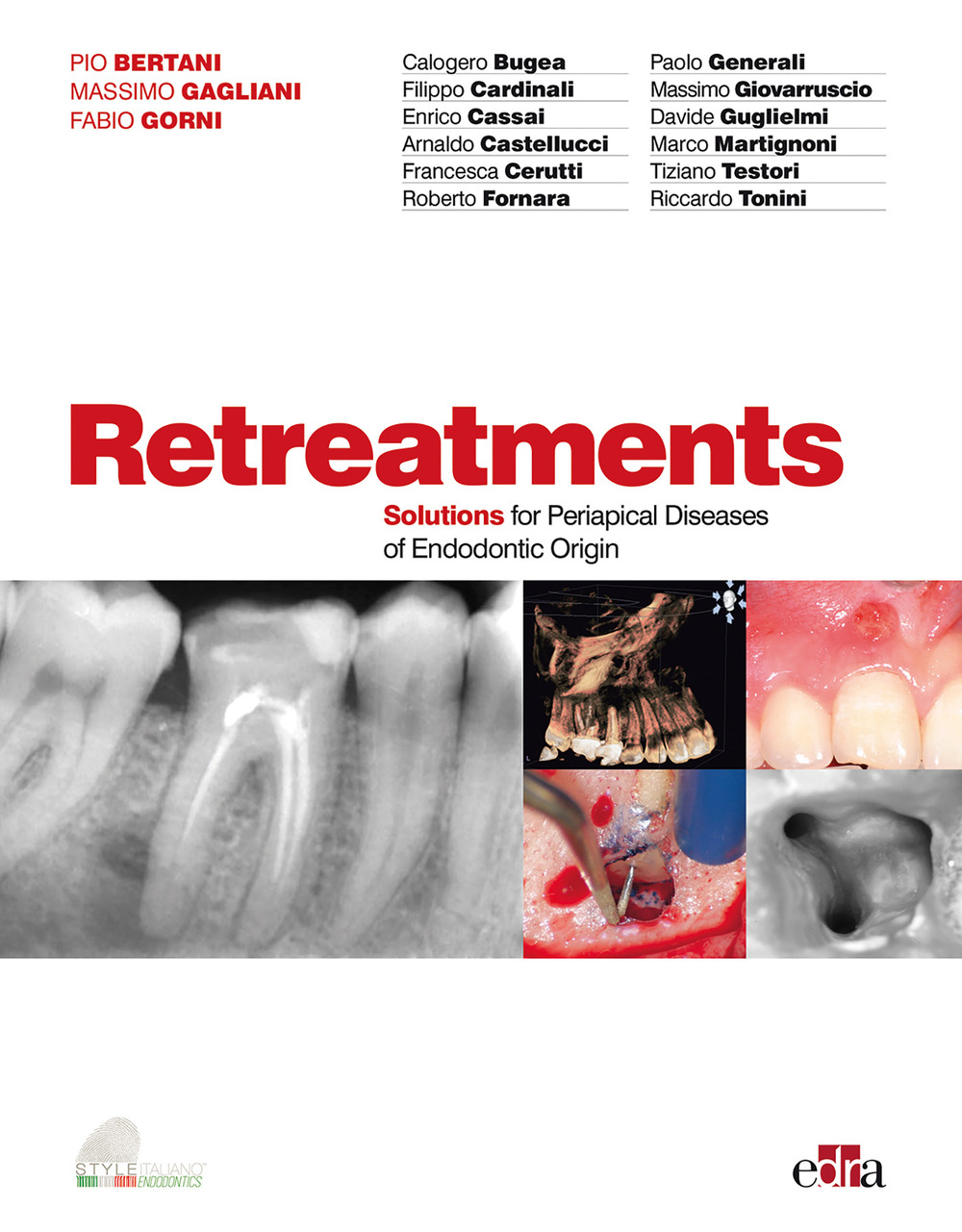 Retreatments. Solutions for periapical diseases of endodontic origin