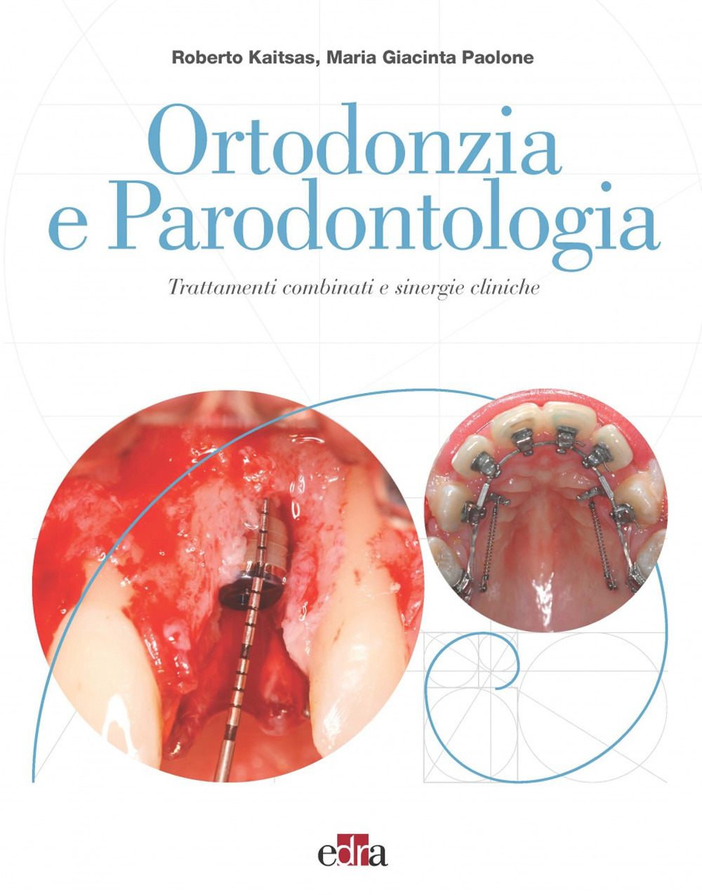 Ortodonzia e parodontologia. Trattamenti combinati e sinergie cliniche