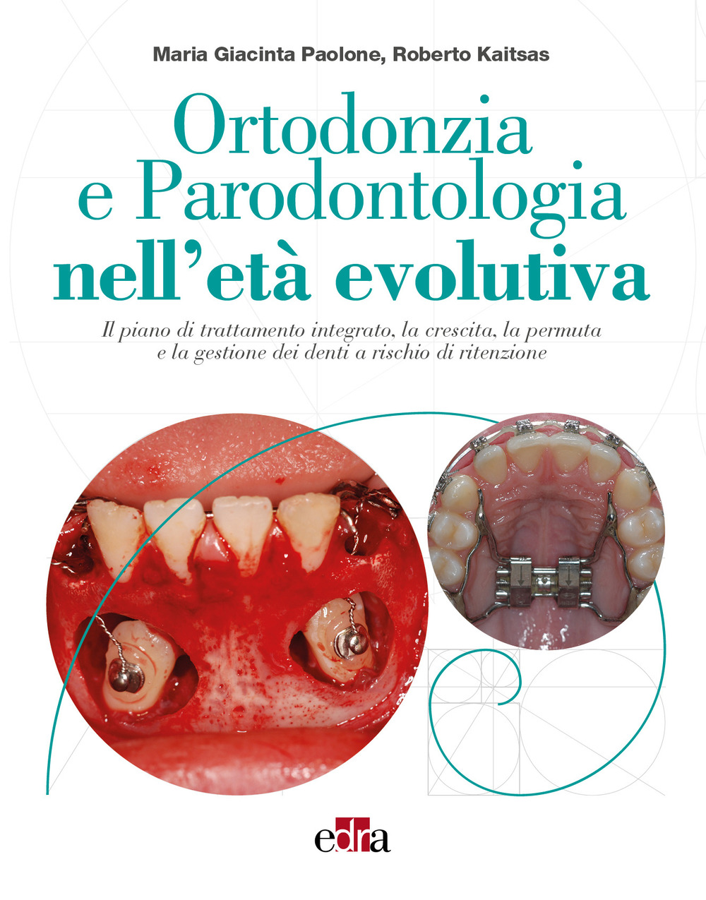 Ortodonzia e parodontologia nell'età evolutiva. Il piano di trattamento integrato, la crescita, la permuta e la gestione dei denti a rischio di ritenzione