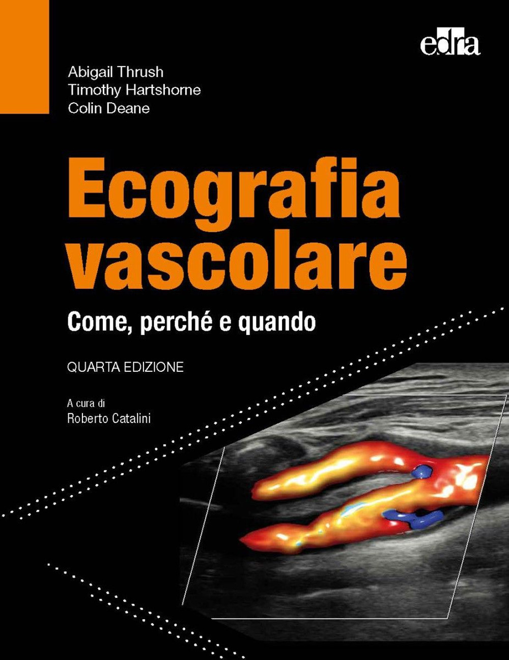 Ecografia vascolare. Come, perché e quando