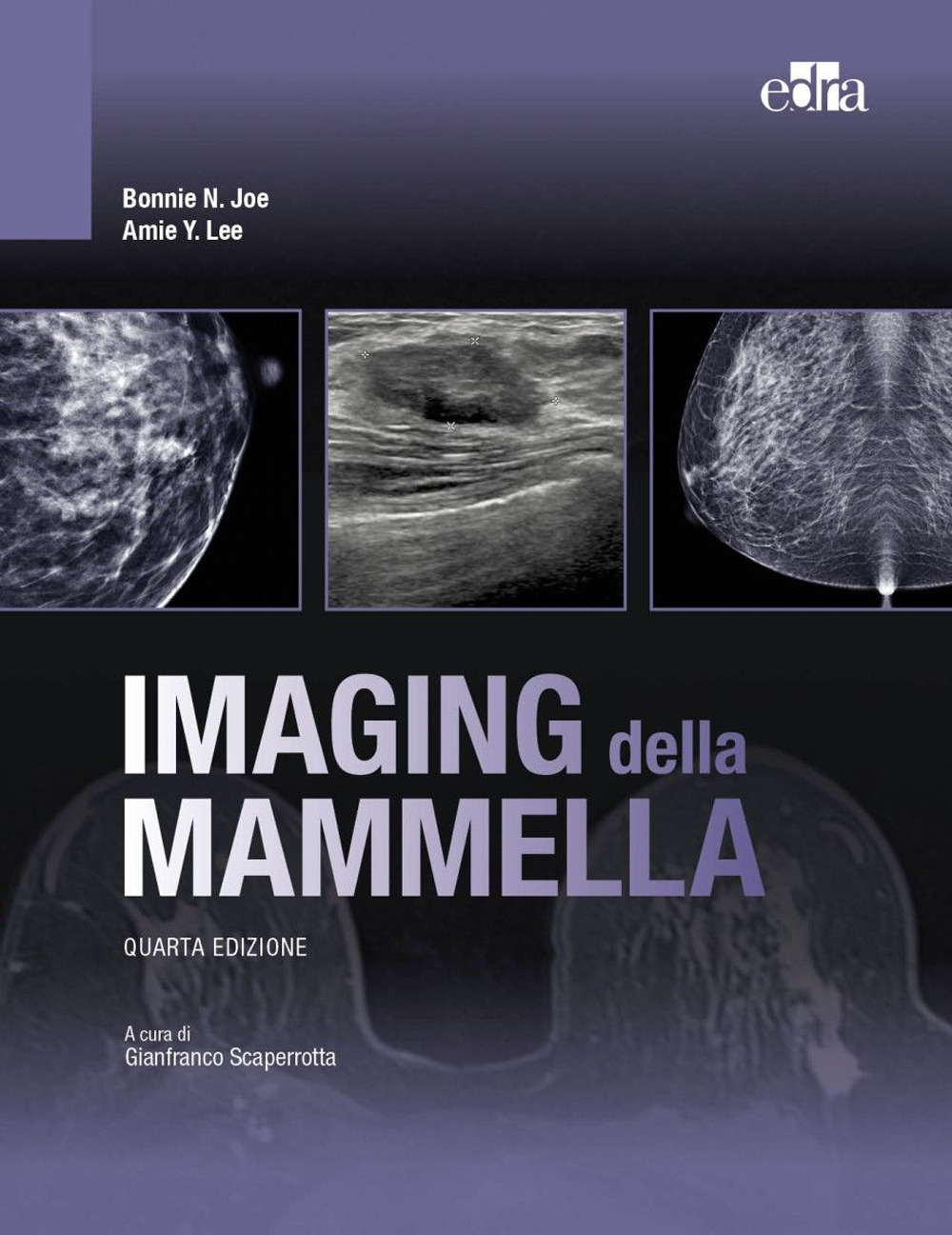 Imaging della mammella