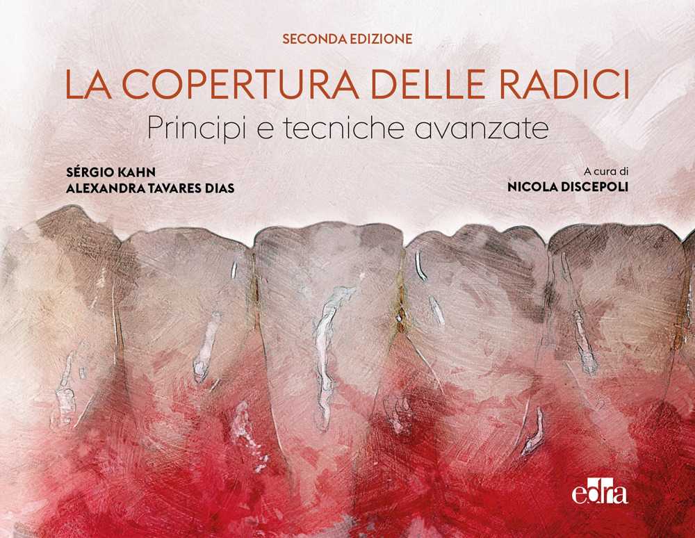 La copertura delle radici. Principi e tecniche avanzate. Con QR Code