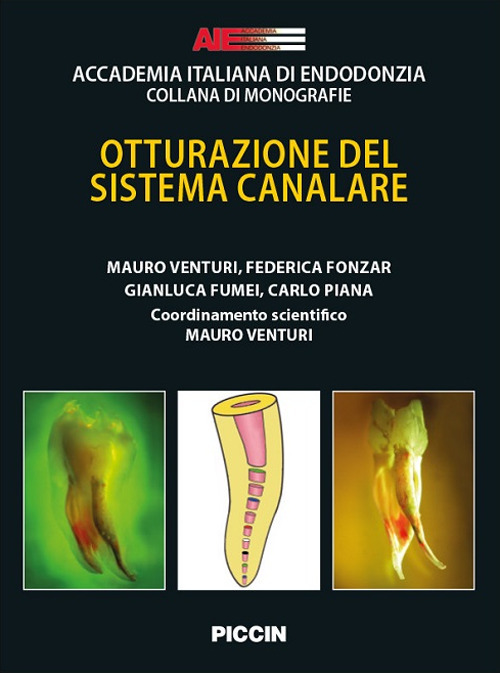 Otturazione del sistema canalare