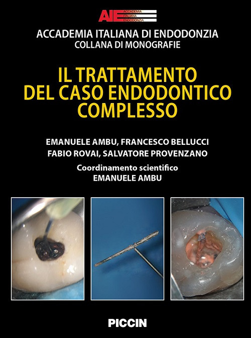 Il trattamento del caso endodontico complesso