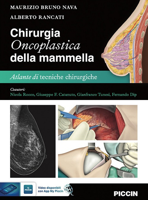 Chirurgia oncoplastica della mammella. Atlante di tecniche chirurgiche