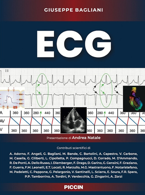 ECG