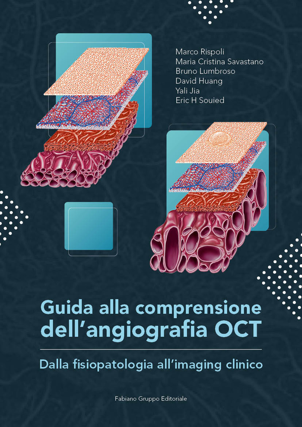 Guida alla comprensione dell'angiografia OCT. Dalla fisiopatologia all'imaging clinico