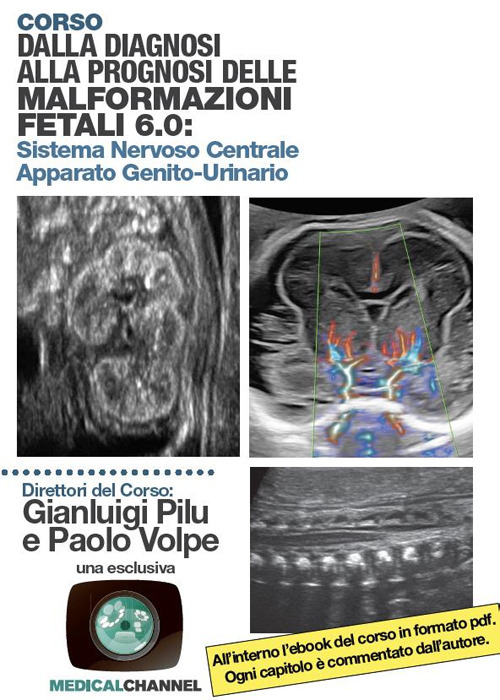 Dalla diagnosi alla prognosi delle malformazioni fetali 6.0