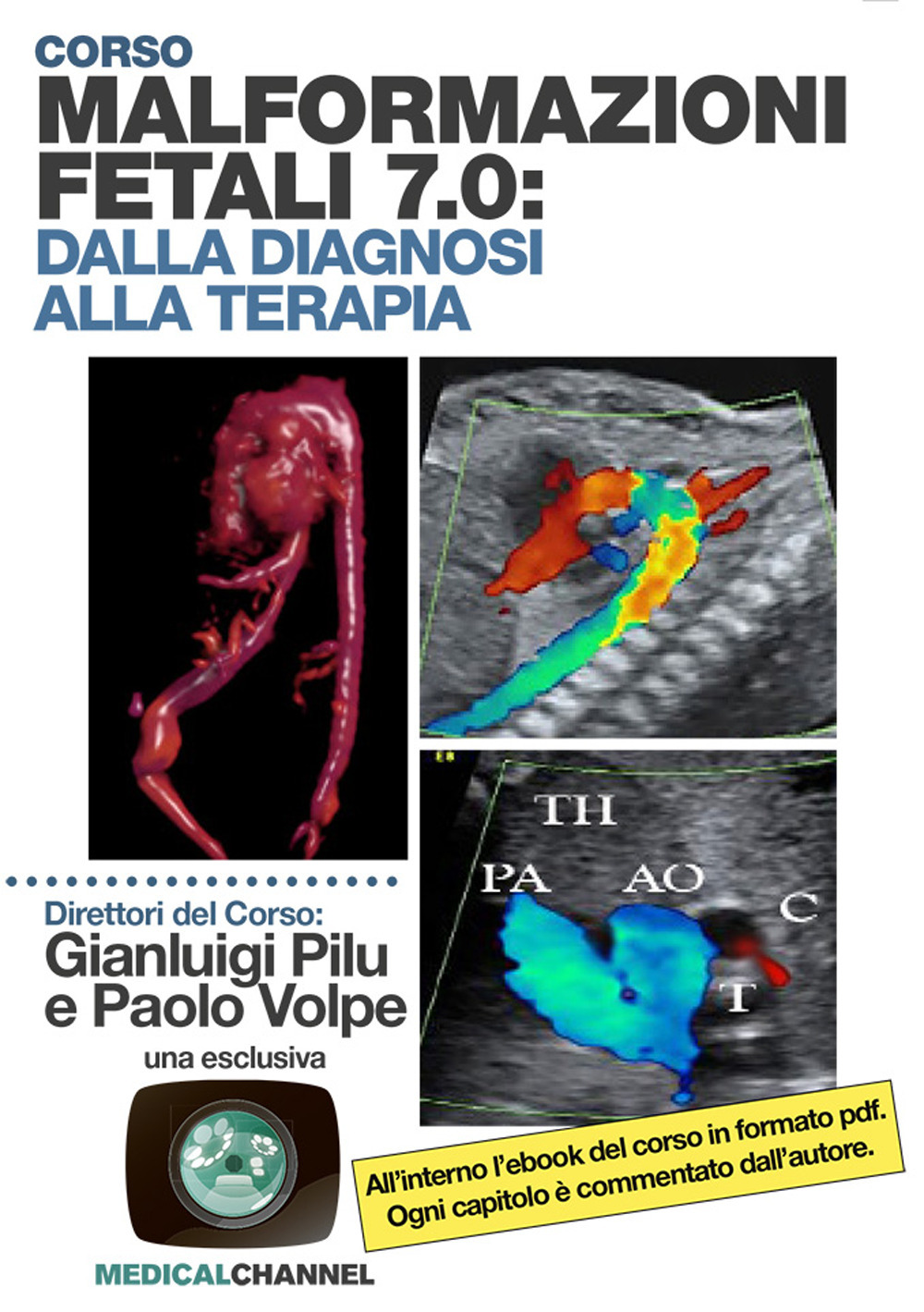 Malformazioni fetali 7.0: dalla diagnosi alla terapia