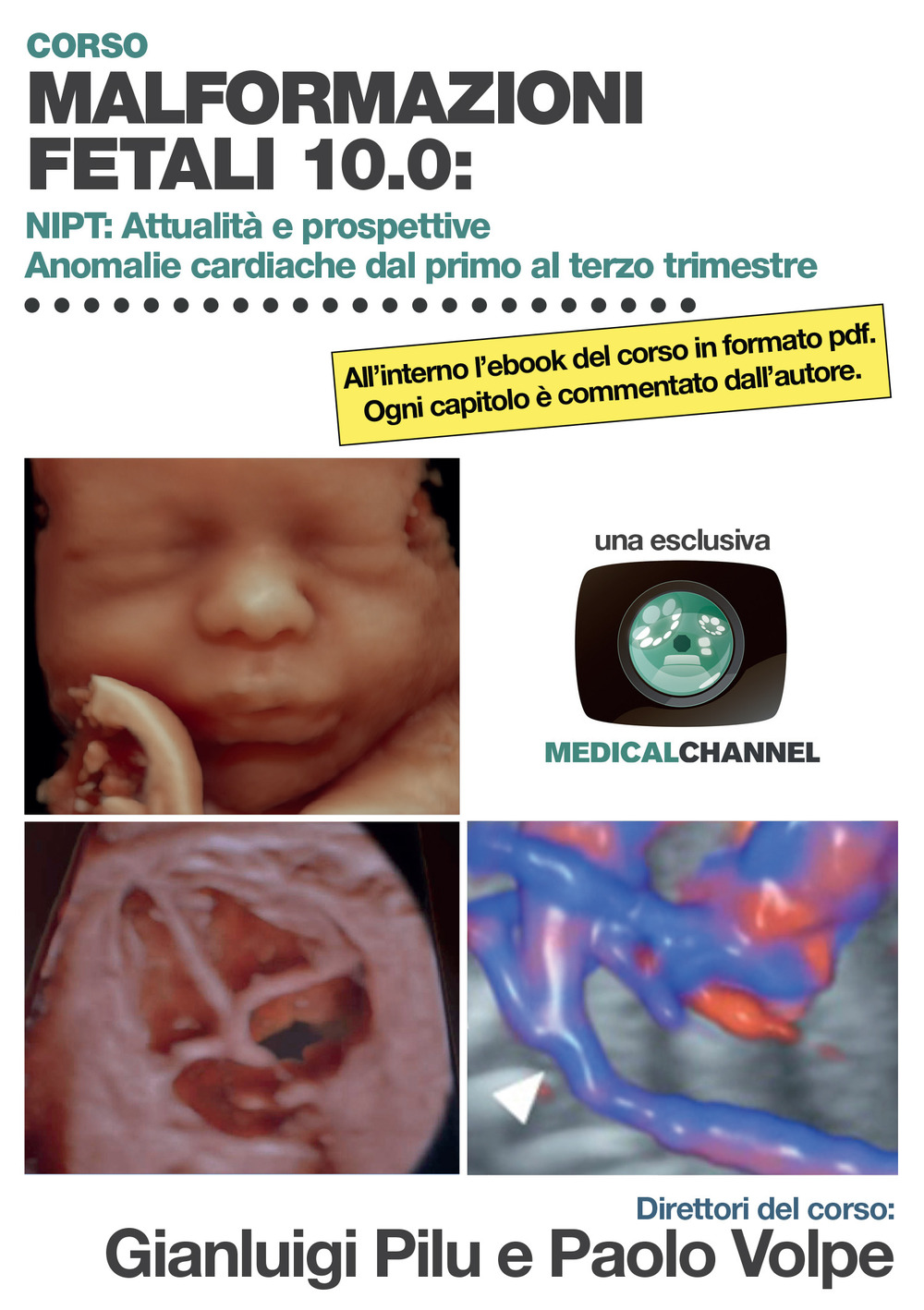 Malformazioni fetali 10.0