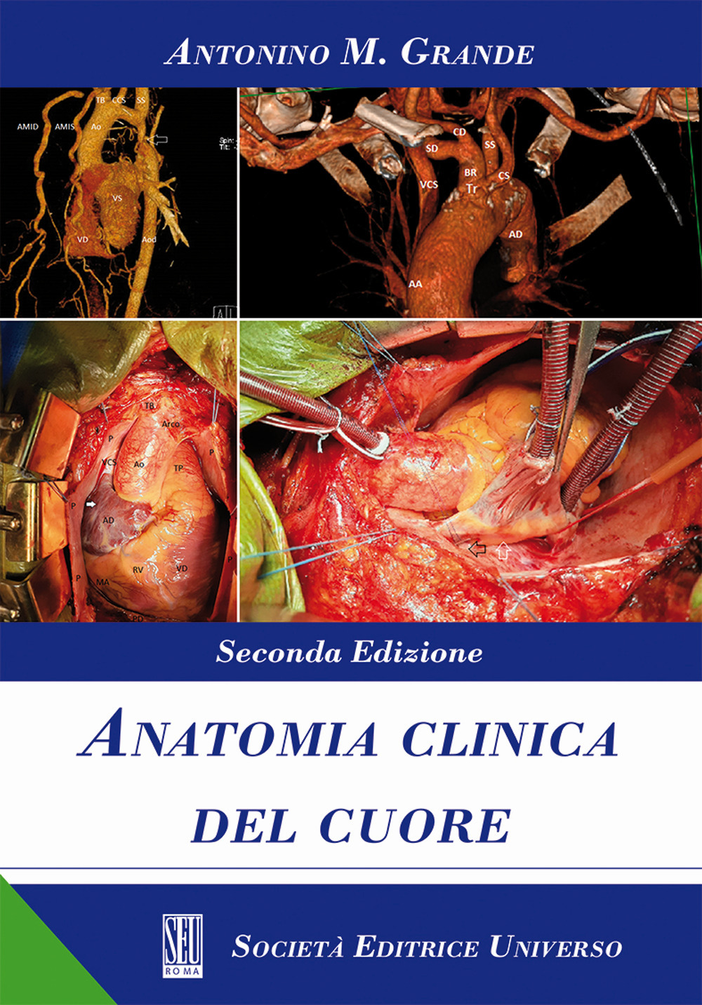 Anatomia clinica del cuore