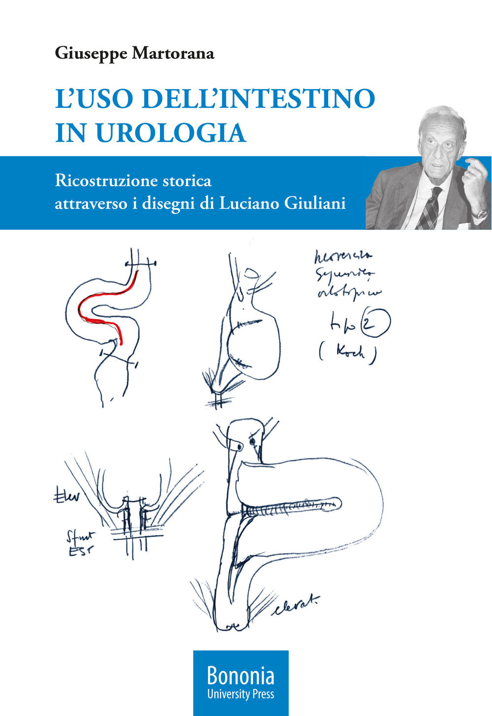 L'uso dell'intestino in urologia. Ricostruzione storica attraverso i disegni di Luciano Giuliani