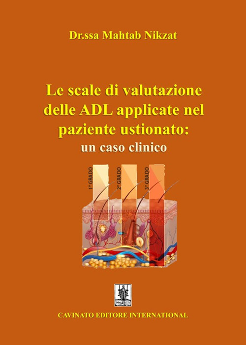 Le scale di valutazione delle ADL applicate nel paziente ustionato: un caso clinico. Ediz. illustrata