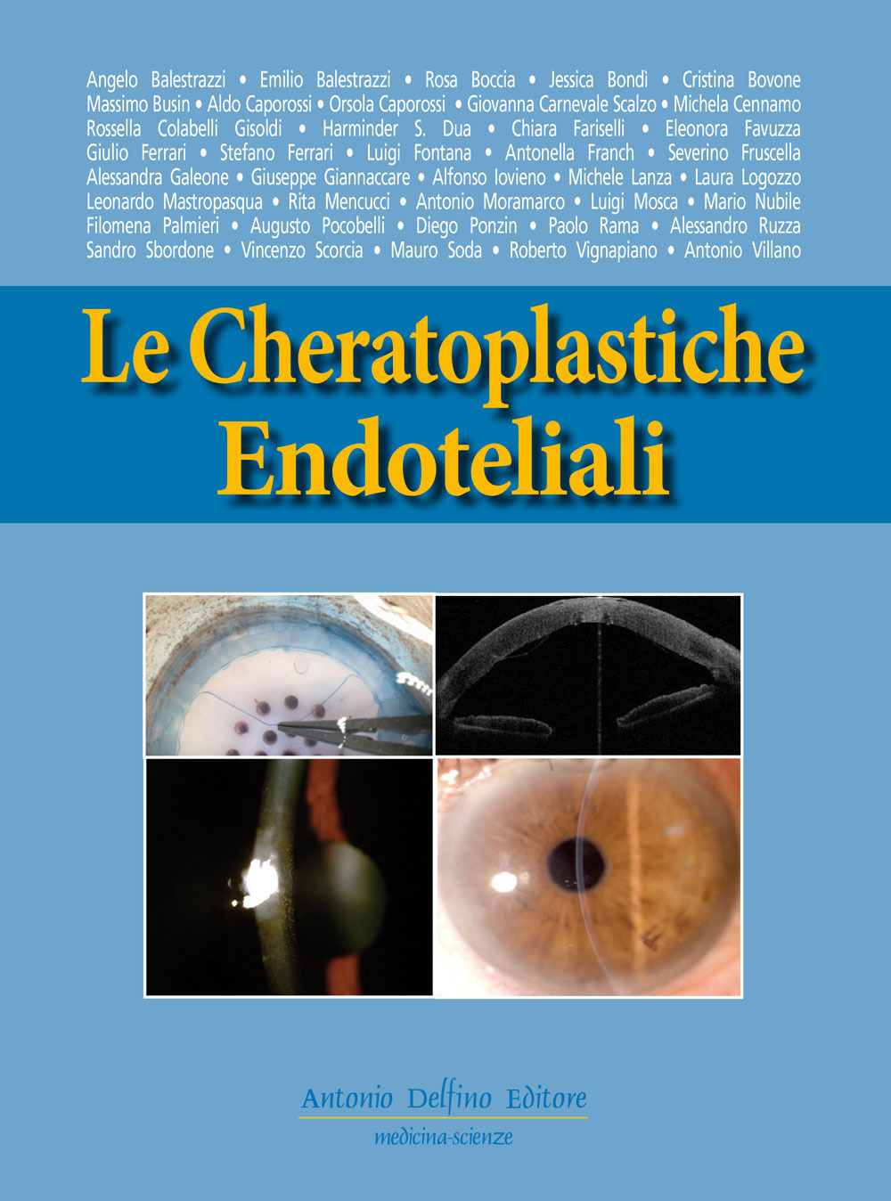 Le cheratoplastiche endoteliali