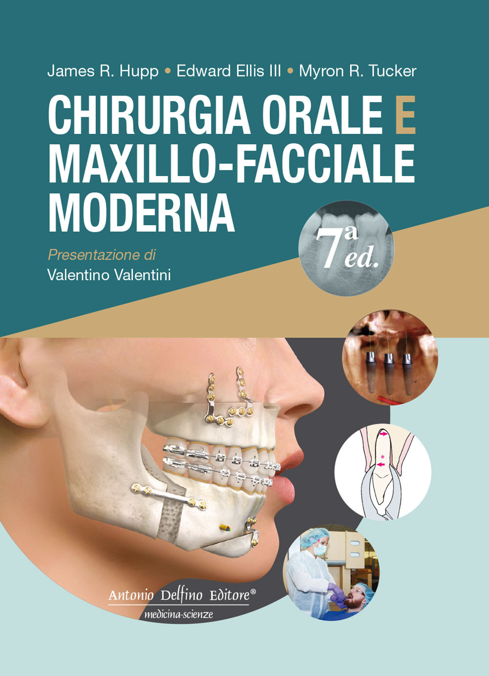 Chirurgia orale e maxillo-facciale moderna