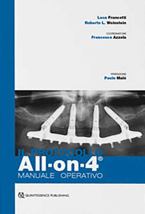 All-on-4. Manuale operativo