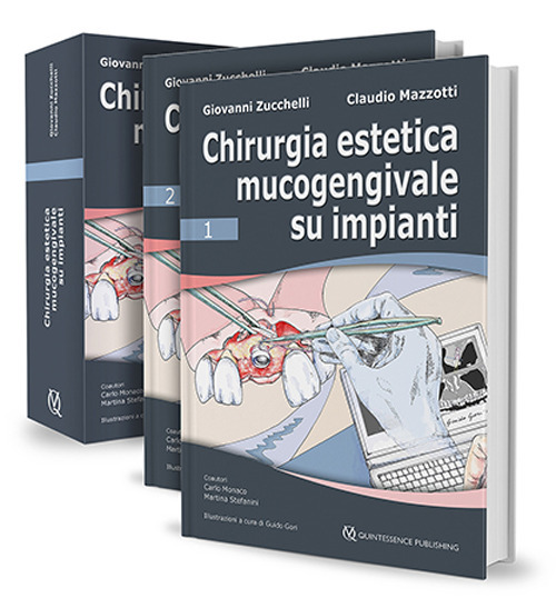 Chirurgia estetica mucogengivale su impianti