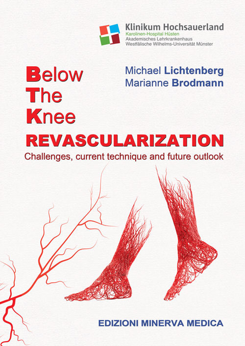 Below the knee revascularization. Challenges, current technique and future outlook