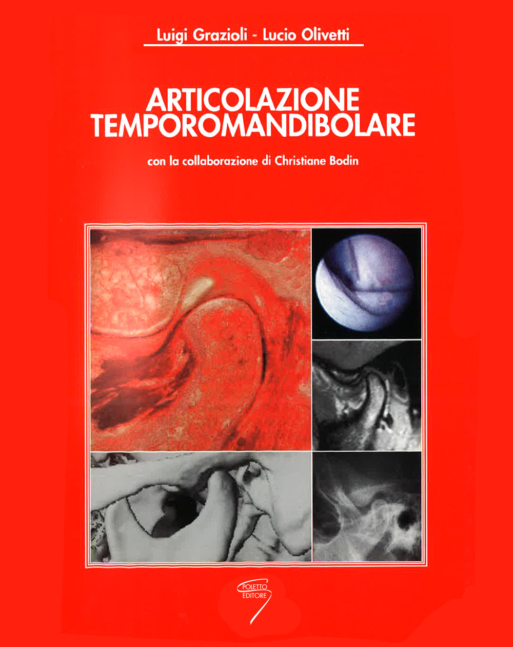 Articolazione temporomandibolare