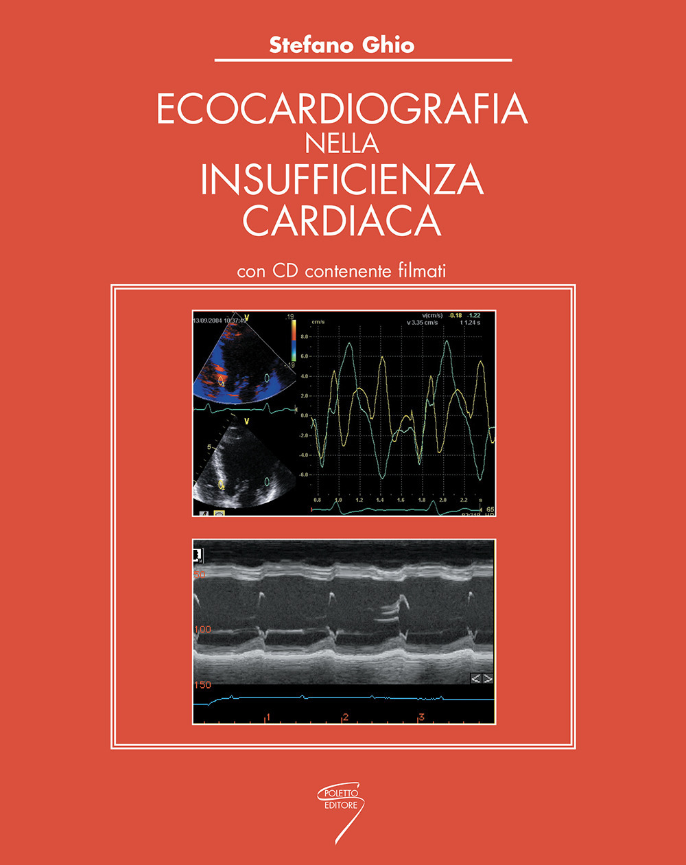 Ecocardiografia nell'insufficienza cardiaca. Con CD-ROM