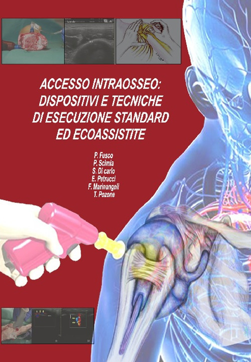 Accesso intraosseo. Dispositivi e tecniche di esecuzione standard ed ecoassistite. Con Scheda riassuntiva