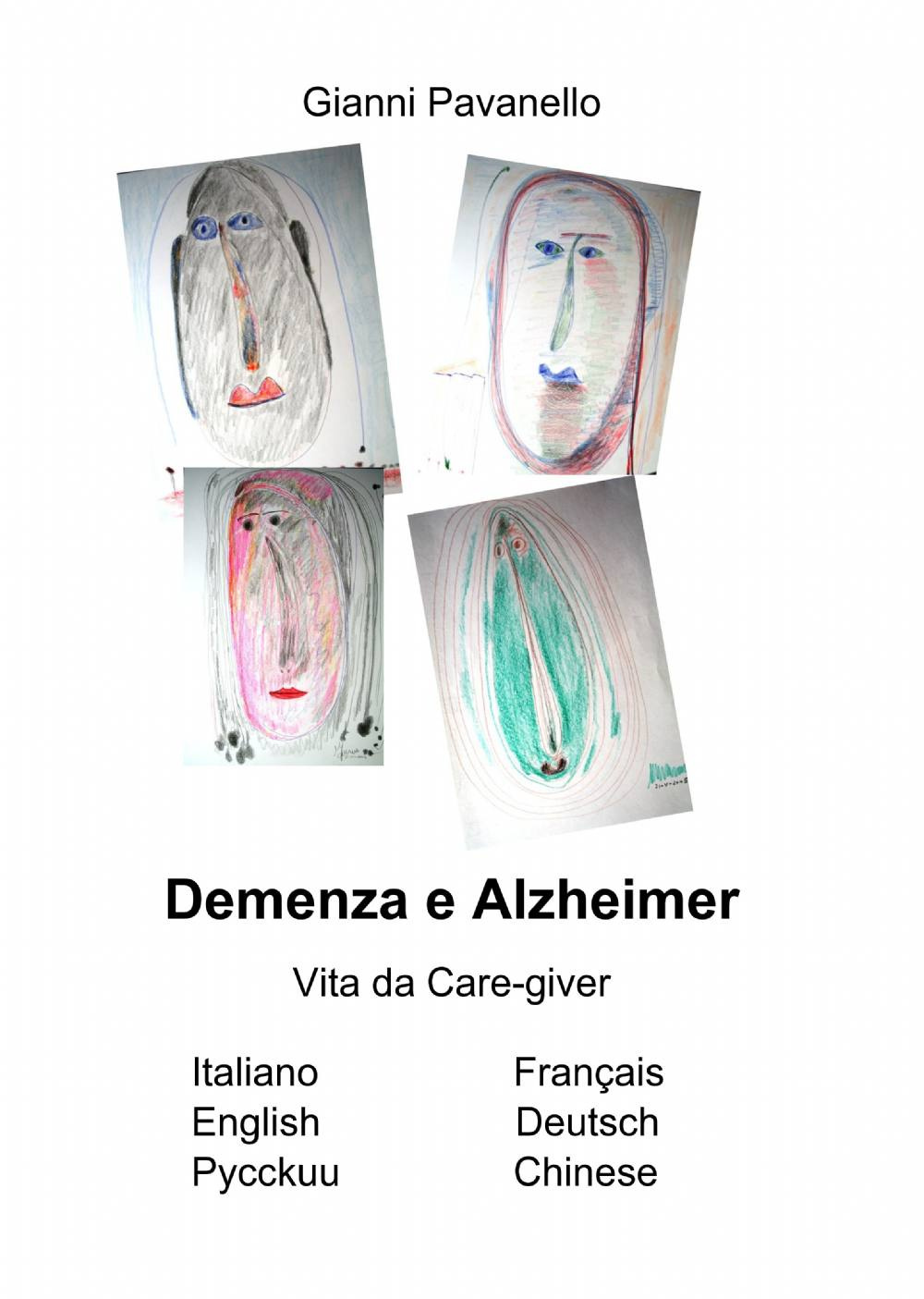 Demenza e alzheimer