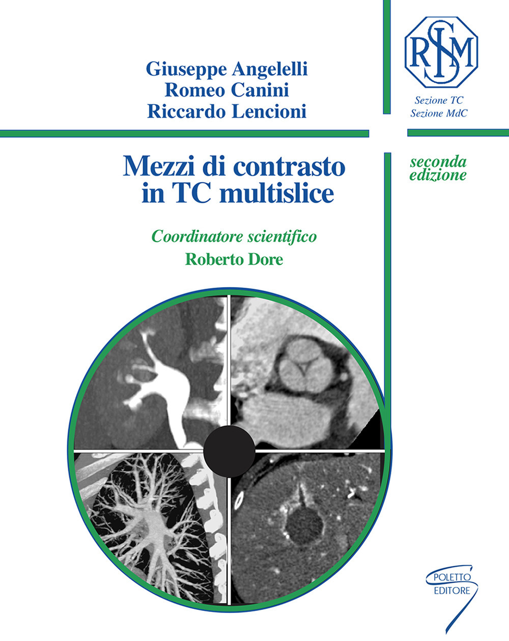 Mezzi di contrasto in TC multislice. Ediz. a spirale