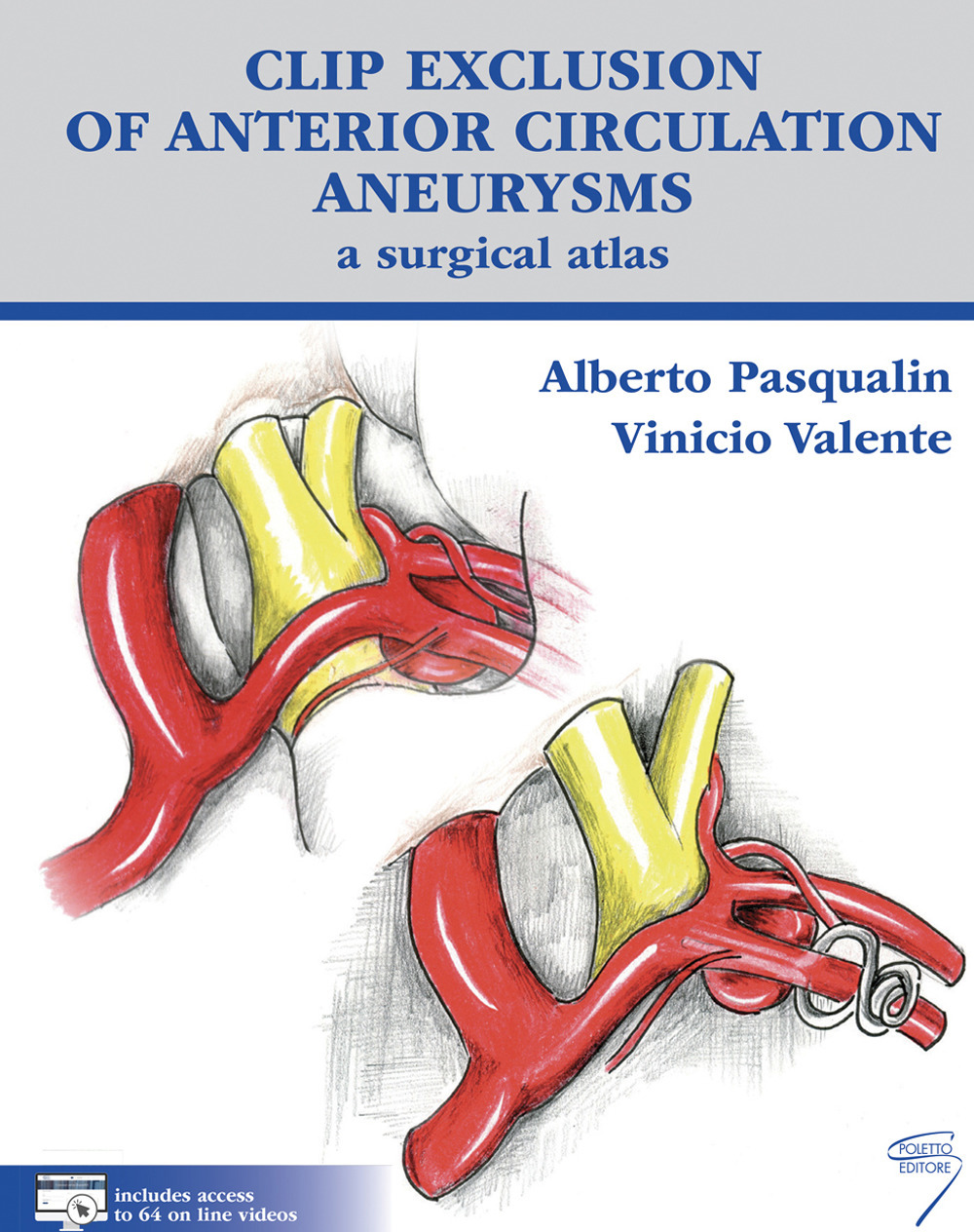 Clip exclusion of anterior circulation aneurysms: a surgical atlas. Con Contenuto digitale per download e accesso online