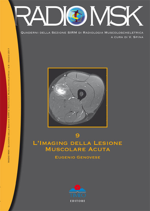 L'imaging della lesione muscolare acuta