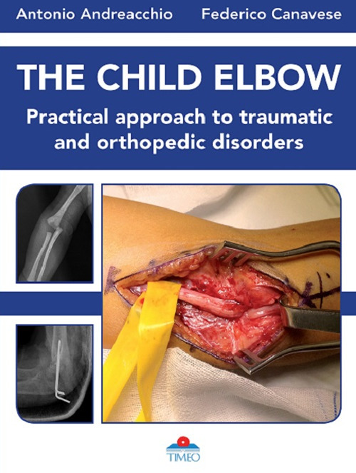The child elbow. Practical approach to traumatic and orthopedic disorders