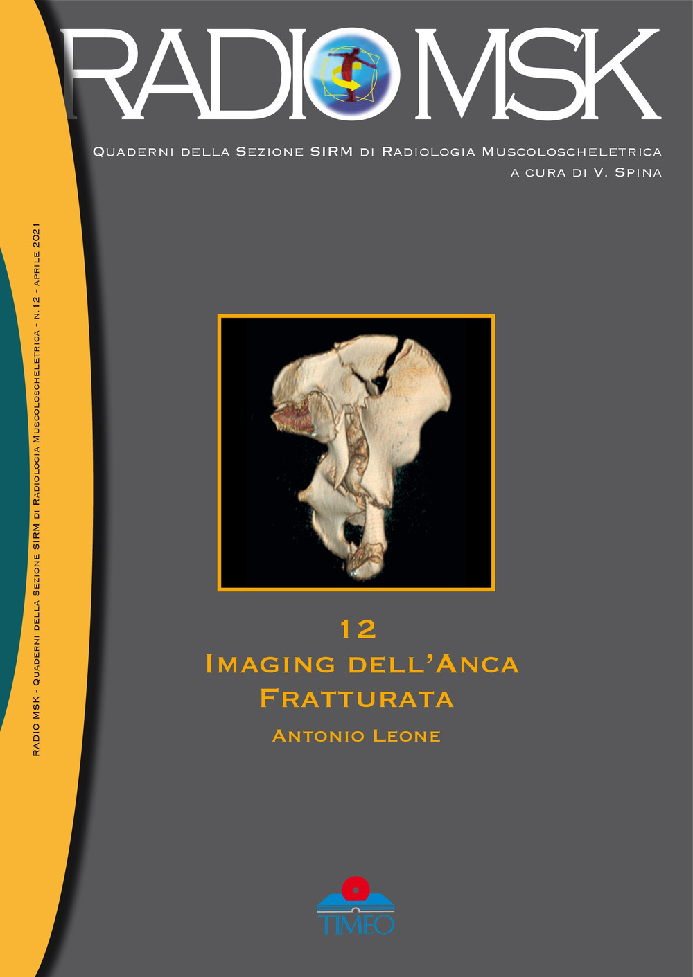 Imaging dell'anca fratturata