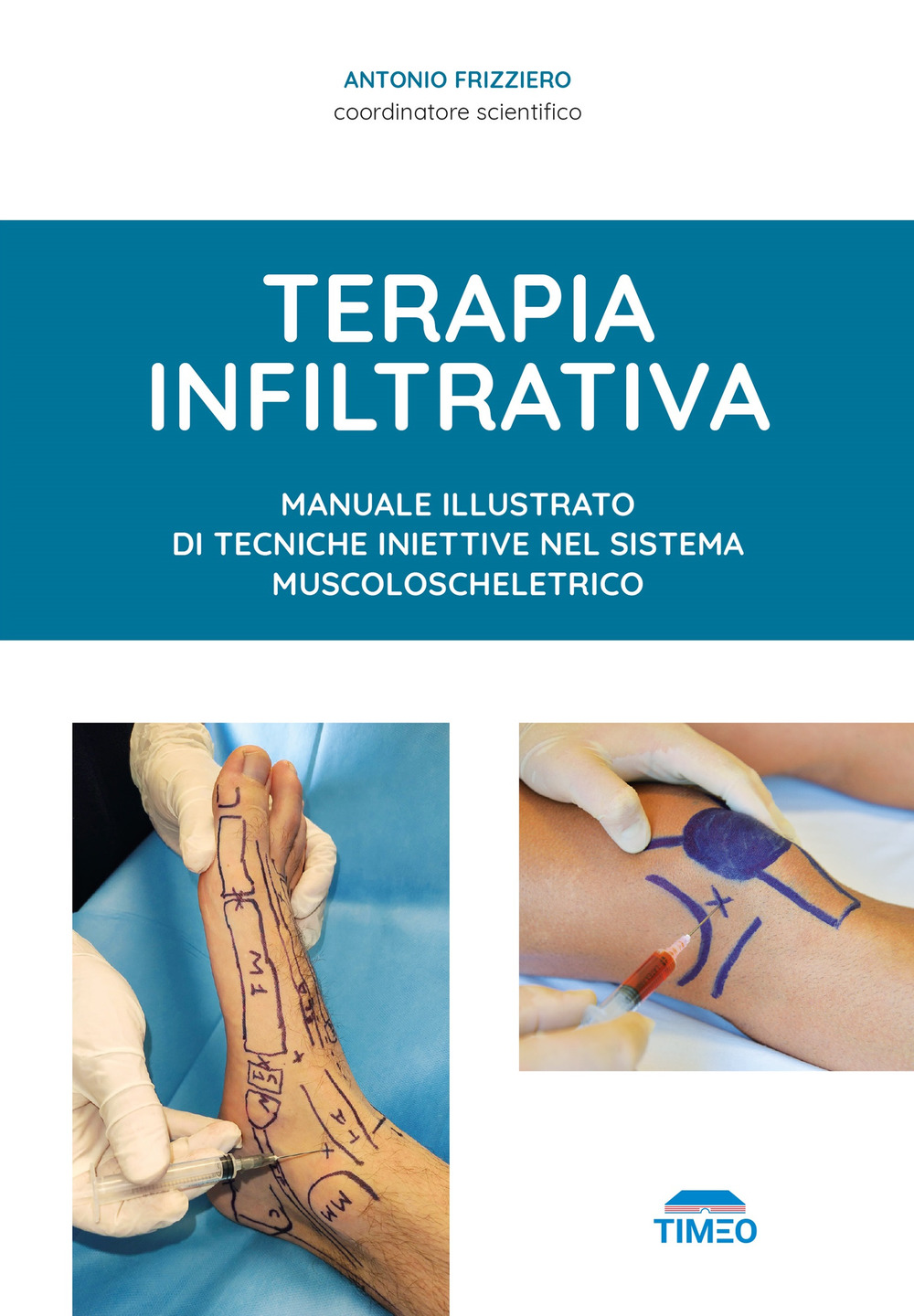 Terapia infiltrativa. Manuale illustrato di tecniche iniettive nel sistema muscolo-scheletrico