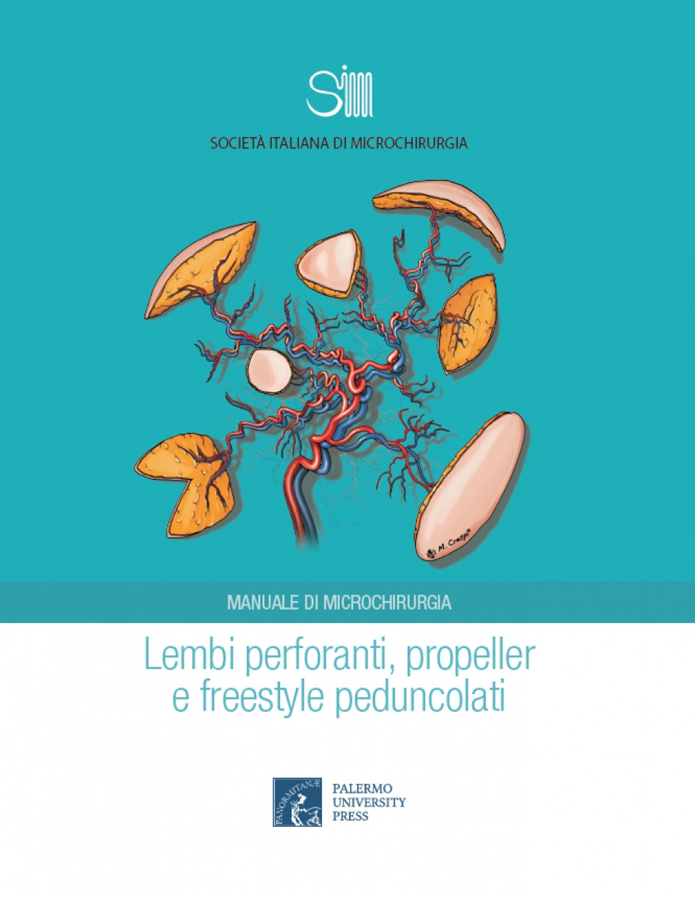 Lembi perforanti, propeller e freestyle peduncolati